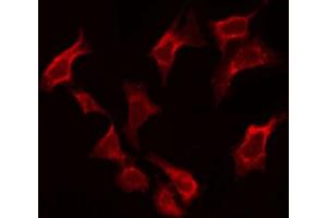 ABIN6274145 staining Hela by IF/ICC. (BAF53A antibody  (Internal Region))