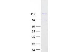 Western Blotting (WB) image for Homeodomain Interacting Protein Kinase 2 (HIPK2) (Transcript Variant 1) protein (Myc-DYKDDDDK Tag) (ABIN2722766)