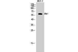 Western Blotting (WB) image for anti-V-Akt Murine Thymoma Viral Oncogene Homolog 1 (AKT1) (Ser137) antibody (ABIN3173746) (AKT1 antibody  (Ser137))