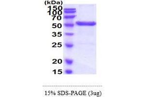 SDS-PAGE (SDS) image for Uridine Monophosphate Synthetase (UMPS) (AA 1-480) protein (His tag) (ABIN6388096) (UMPS Protein (AA 1-480) (His tag))