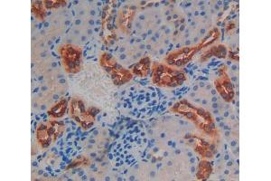 Used in DAB staining on fromalin fixed paraffin- embedded Kidney tissue (MOCS1 antibody  (AA 457-636))