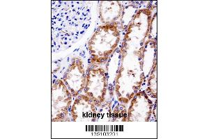 DNMT3A Antibody (Center R478WMutant) immunohistochemistry analysis in formalin fixed and paraffin embedded human kidney tissue followed by peroxidase conjugation of the secondary antibody and DAB staining.