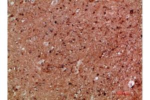 Immunohistochemical analysis of paraffin-embedded human-brain, antibody was diluted at 1:200 (IKBKG antibody  (AA 60-120))