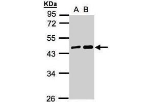 WB Image Sample(30 ug whole cell lysate) A:A431, B:H1299 10% SDS PAGE antibody diluted at 1:5000 (MAGEA11 antibody  (N-Term))