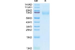 Human MSR1 on Tris-Bis PAGE under reduced condition. (Macrophage Scavenger Receptor 1 Protein (MSR1) (AA 77-451) (His tag))