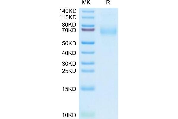 Macrophage Scavenger Receptor 1 Protein (MSR1) (AA 77-451) (His tag)