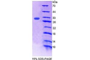 SDS-PAGE (SDS) image for Runt-Related Transcription Factor 3 (RUNX3) (AA 1-250) protein (His tag) (ABIN6239502)