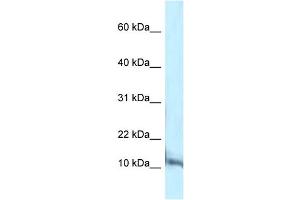 WB Suggested Anti-Pcbd1 Antibody Titration: 1. (PCBD1 antibody  (C-Term))