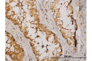 Immunoperoxidase of monoclonal antibody to NME2 on formalin-fixed paraffin-embedded human testis. (NME2 antibody  (AA 51-152))