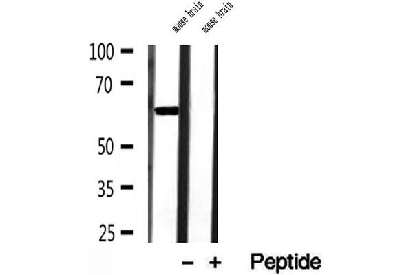 HEPACAM antibody  (C-Term)