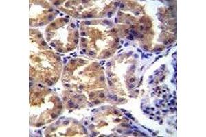 TRPM6 antibody  (AA 317-348)