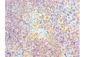 Immunohistochemistry of paraffin-embedded human tonsil tissue using ABIN7157727 at dilution of 1:100 (KLF4 antibody  (AA 30-230))