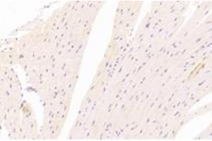 Immunohistochemistry (Paraffin-embedded Sections) (IHC (p)) image for anti-5'-Nucleotidase, Cytosolic IB (NT5C1B) antibody (ABIN7072861)