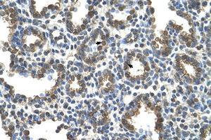 Image no. 1 for anti-Solute Carrier Family 37 (Glycerol-3-Phosphate Transporter), Member 3 (SLC37A3) (AA 224-273) antibody (ABIN6736664) (SLC37A3 antibody  (AA 224-273))
