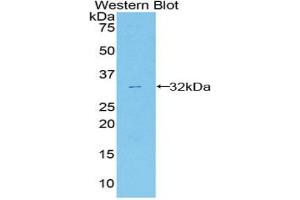 Western blot analysis of the recombinant protein. (ANXA6 antibody  (AA 251-504))