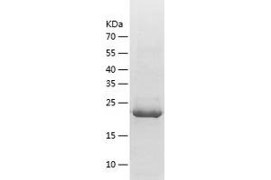 Western Blotting (WB) image for Lin-7 Homolog A (LIN7A) (AA 1-233) protein (His tag) (ABIN7284322) (LIN7A Protein (AA 1-233) (His tag))