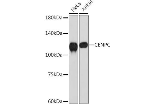 Centromere Protein C Pseudogene 1 (CENPCP1) antibody