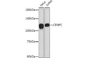 Centromere Protein C Pseudogene 1 (CENPCP1) antibody