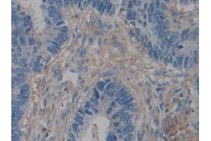 Immunohistochemistry (IHC) image for anti-Actin, gamma 2, Smooth Muscle, Enteric (ACTG2) (AA 3-376) antibody (ABIN7440569)