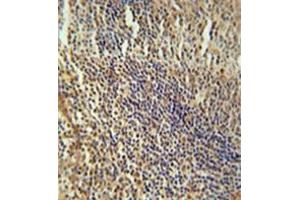 Immunohistochemistry analysis in formalin fixed and paraffin embedded human tonsil tissue reacted with MEF2A Antibody (Center) followed which was peroxidase conjugated to the secondary antibody and followed by DAB staining. (MEF2A antibody  (Middle Region))