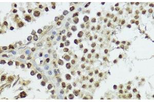 Immunohistochemistry of paraffin-embedded Rat testis using Phospho-Histone H3(T11) Polyclonal Antibody at dilution of 1:100 (40x lens). (Histone 3 antibody  (pThr11))