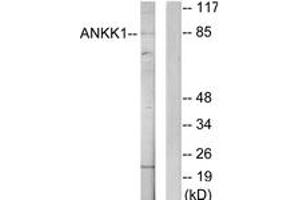 Western Blotting (WB) image for anti-Ankyrin Repeat and Protein Kinase Domain-Containing Protein 1 (ANKK1) (AA 321-370) antibody (ABIN2889681) (ANKK1 antibody  (AA 321-370))
