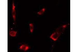 ABIN6275670 staining LOVO cells by IF/ICC. (VPS26B antibody  (Internal Region))