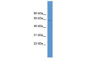 WB Suggested Anti-TMEM180 Antibody Titration:  0. (TMEM180 antibody  (Middle Region))