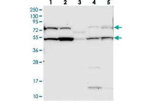 Western blot analysis of Lane 1: RT-4, Lane 2: U-251 MG, Lane 3: Human Plasma, Lane 4: Liver, Lane 5: Tonsil with C10orf90 polyclonal antibody .