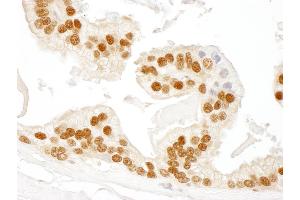 anti-RAD23 Homolog B (RAD23B) (AA 359-409) antibody