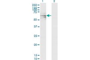 Western Blot analysis of GATAD2A expression in transfected 293T cell line by GATAD2A monoclonal antibody (M01), clone 3F3. (GATAD2A antibody  (AA 26-134))
