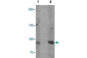 Western blot analysis of rat heart tissue lysate with FCHO2 polyclonal antibody  at (1) 1 and (2) 2 ug/mL.