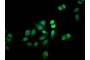 Immunofluorescence staining of Hela cells with ABIN7160633 at 1:33, counter-stained with DAPI. (MTMR12 antibody  (AA 188-318))