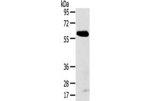 Gel: 8 % SDS-PAGE,Lysate: 40 μg,Primary antibody: ABIN7192624(SPATA18 Antibody) at dilution 1/250 dilution,Secondary antibody: Goat anti rabbit IgG at 1/8000 dilution,Exposure time: 5 minutes (SPATA18 antibody)