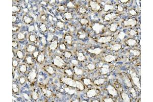 IHC analysis of ASAH1 using anti-ASAH1 antibody (ABIN7602206). (ASAH1 antibody  (AA 63-393))