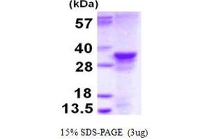 SDS-PAGE (SDS) image for MRG-Binding Protein (MRGBP) (AA 1-204) protein (His tag) (ABIN7279641) (MRGBP Protein (AA 1-204) (His tag))