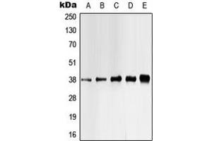 Western blot analysis of CK1 alpha (pY321) expression in HEK293T UV-treated (A), Jurkat (B), K562 (C), mouse liver (D), H9C2 UV-treated (E) whole cell lysates. (CSNK1A1 antibody  (C-Term, pTyr321))