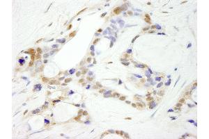 anti-Cleavage and Polyadenylation Specific Factor 2, 100kDa (CPSF2) (AA 450-500) antibody