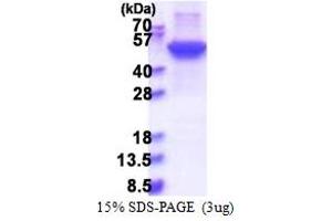 Keratin 17 (KRT17) (AA 1-432) protein (His tag)