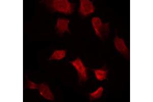 ABIN6267632 staining 293 by IF/ICC. (AMPK alpha antibody  (pThr172))