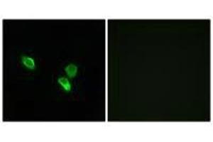 Immunofluorescence analysis of MCF-7 cells, using MRPS18C antibody. (MRPS18C antibody)