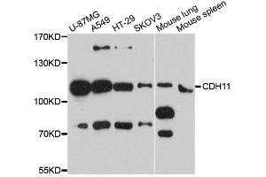 Western blot analysis of extracts of various cell lines, using CDH11 antibody. (OB Cadherin antibody  (AA 637-796))