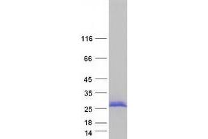 Validation with Western Blot (NCALD Protein (Transcript Variant 3) (Myc-DYKDDDDK Tag))