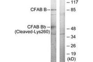 Western Blotting (WB) image for anti-Complement Factor B (CFB) (AA 241-290), (Cleaved-Lys260) antibody (ABIN2891191)