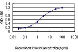 Detection limit for recombinant GST tagged CRYM is approximately 0. (CRYM antibody  (AA 215-314))