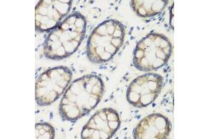 Immunohistochemistry of paraffin-embedded human colon using TGM5 antibody. (Transglutaminase 5 antibody  (AA 461-720))