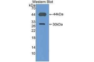 Detection of Recombinant CD4, Mouse using Polyclonal Antibody to Cluster Of Differentiation 4 (CD4) (CD4 antibody  (AA 27-394))