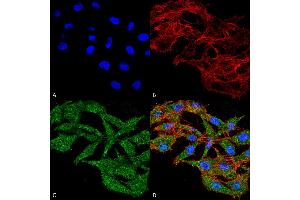 Immunocytochemistry/Immunofluorescence analysis using Rabbit Anti-WDFY3 Polyclonal Antibody . (WDFY3 antibody  (AA 533-544))