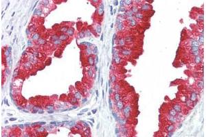 Human Prostate (formalin-fixed, paraffin-embedded) stained with ACPP antibody ABIN364499 at 5 ug/ml followed by biotinylated anti-mouse IgG secondary antibody ABIN481714, alkaline phosphatase-streptavidin and chromogen. (ACPP antibody)