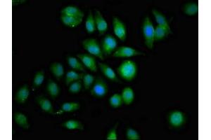 Immunofluorescence staining of A549 cells with ABIN7154498 at 1:100, counter-stained with DAPI. (GRB14 antibody  (AA 294-397))